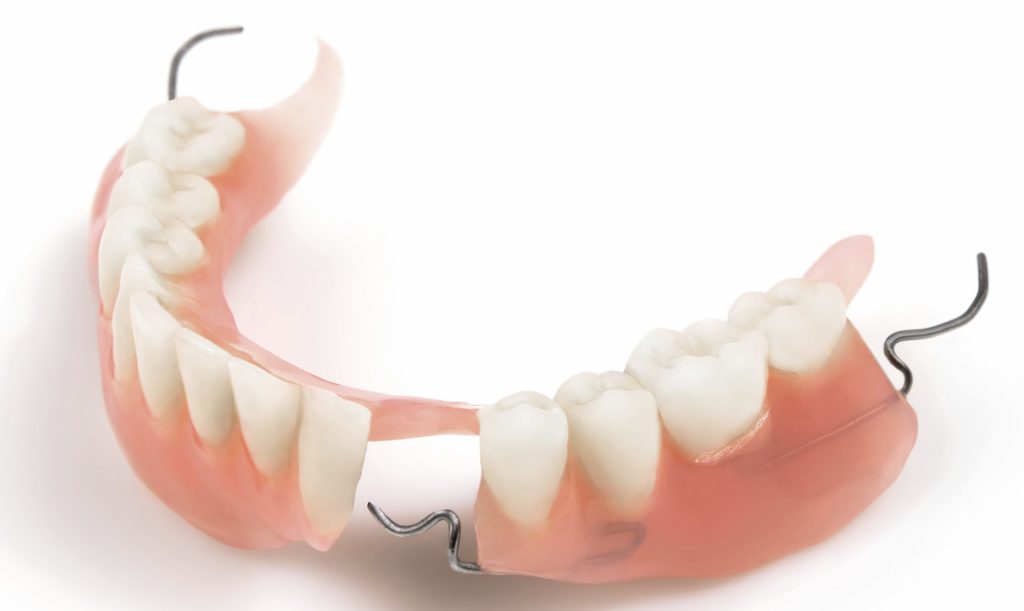 Lower denture with braces on a white background. Horizontal position.