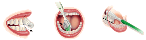 chistka-zubov
